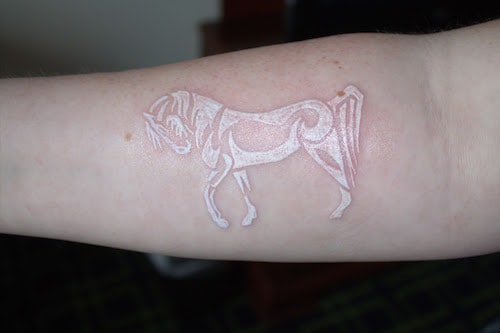 This client is an avid tanner The laser used for the reddish orange ink is  very much attracted to the tan thus the   Tattoo removal Tattoos Tattoo  ink allergy